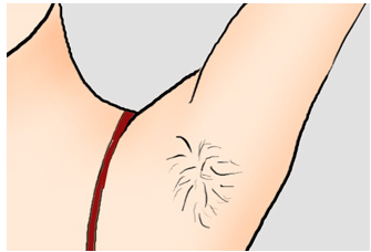從毛茸茸到光滑如絲，最新脫毛價格指南，自信之旅啟程！